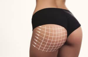 closeup woman beautiful buttocks with arrow grid