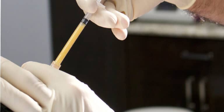 Facial fat Grafting Chicago IL
