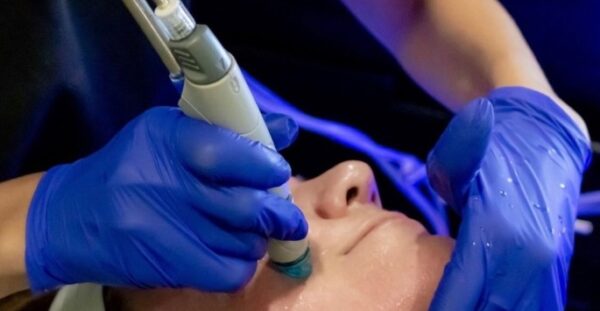 Hydrafacial MDB 1 600x311