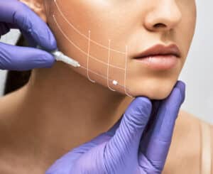 Woman undergoing an instant facelift procedure
