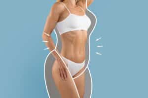A cropped shot of a woman's torso after VASER® liposuction recovery