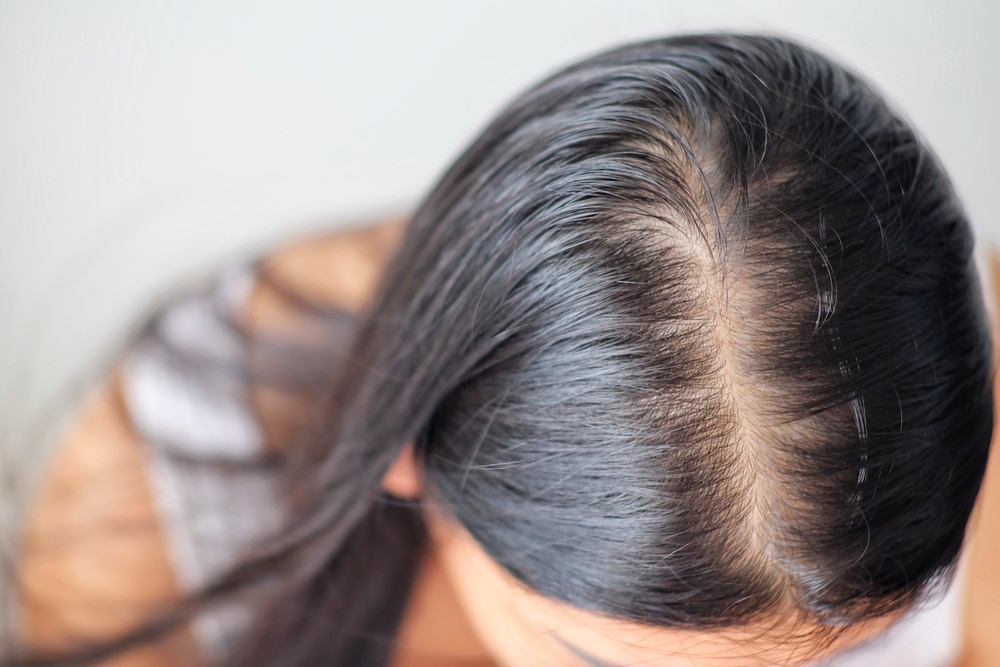 Hair Restoration Lincoln Park IL