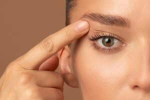 A close-up shot of a woman’s eye after a Plasma Pen treatment