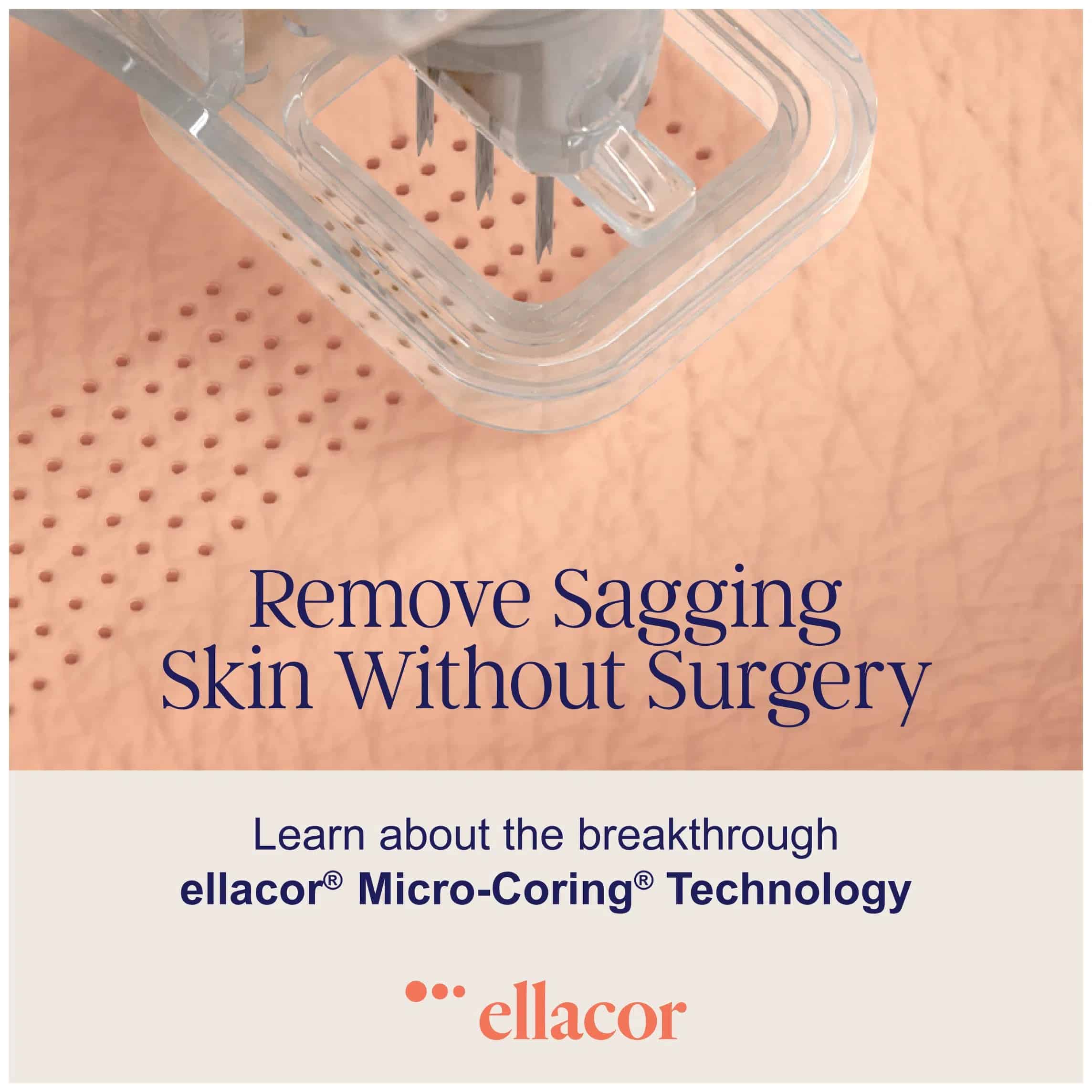 Ellacor Micro-Coring Technology for skin rejuvenation.