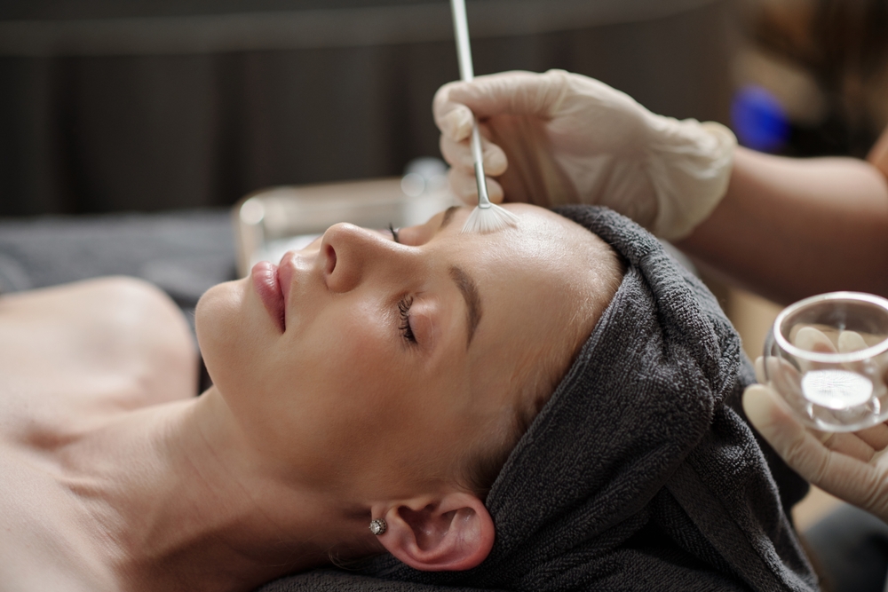 VI Peel treatment at Old Town Med Spa.