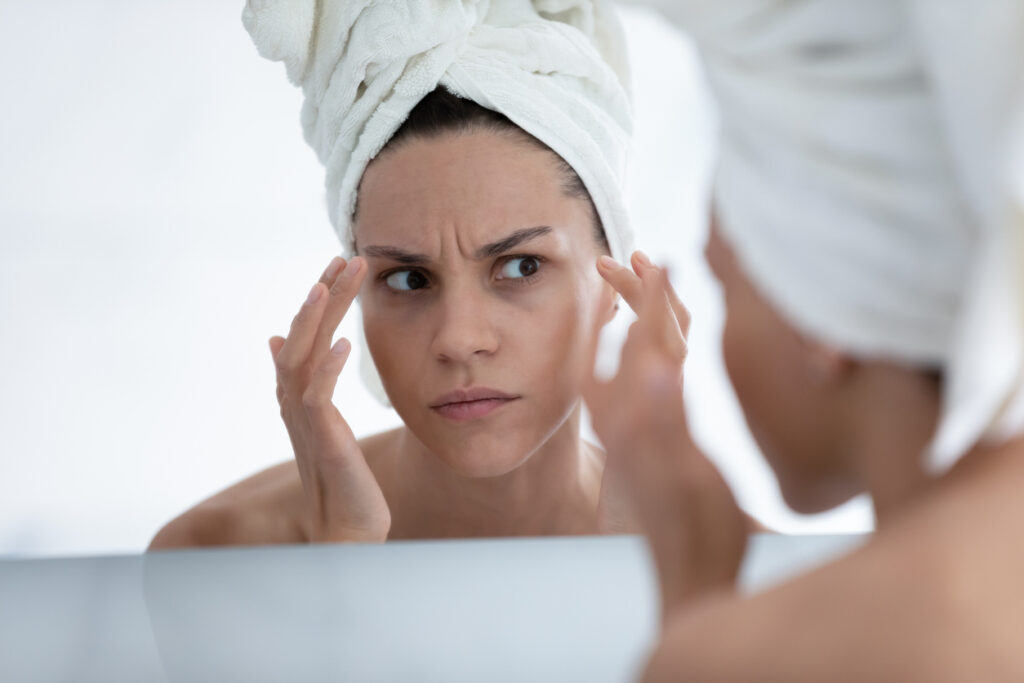 Woman looking in the mirror before XEOMIN injections in Chicago